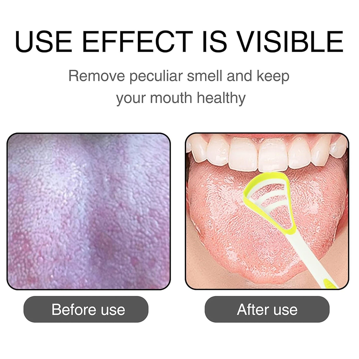 Oral Tongue Cleaner – Stainless Steel Scraper for Personal Dental Care